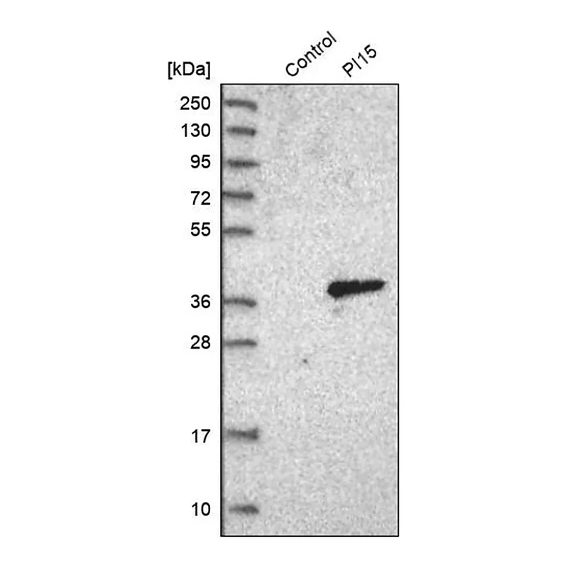 Merck Anti-PI15 antibody produced in rabbit