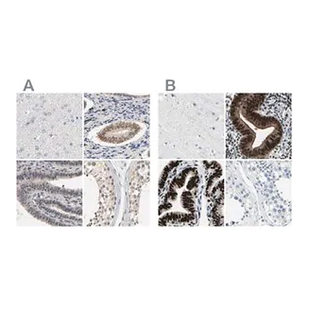 Merck Anti-PGR antibody produced in rabbit