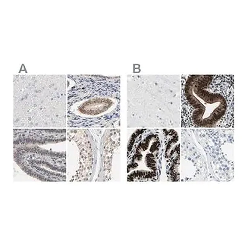 Merck Anti-PGR antibody produced in rabbit