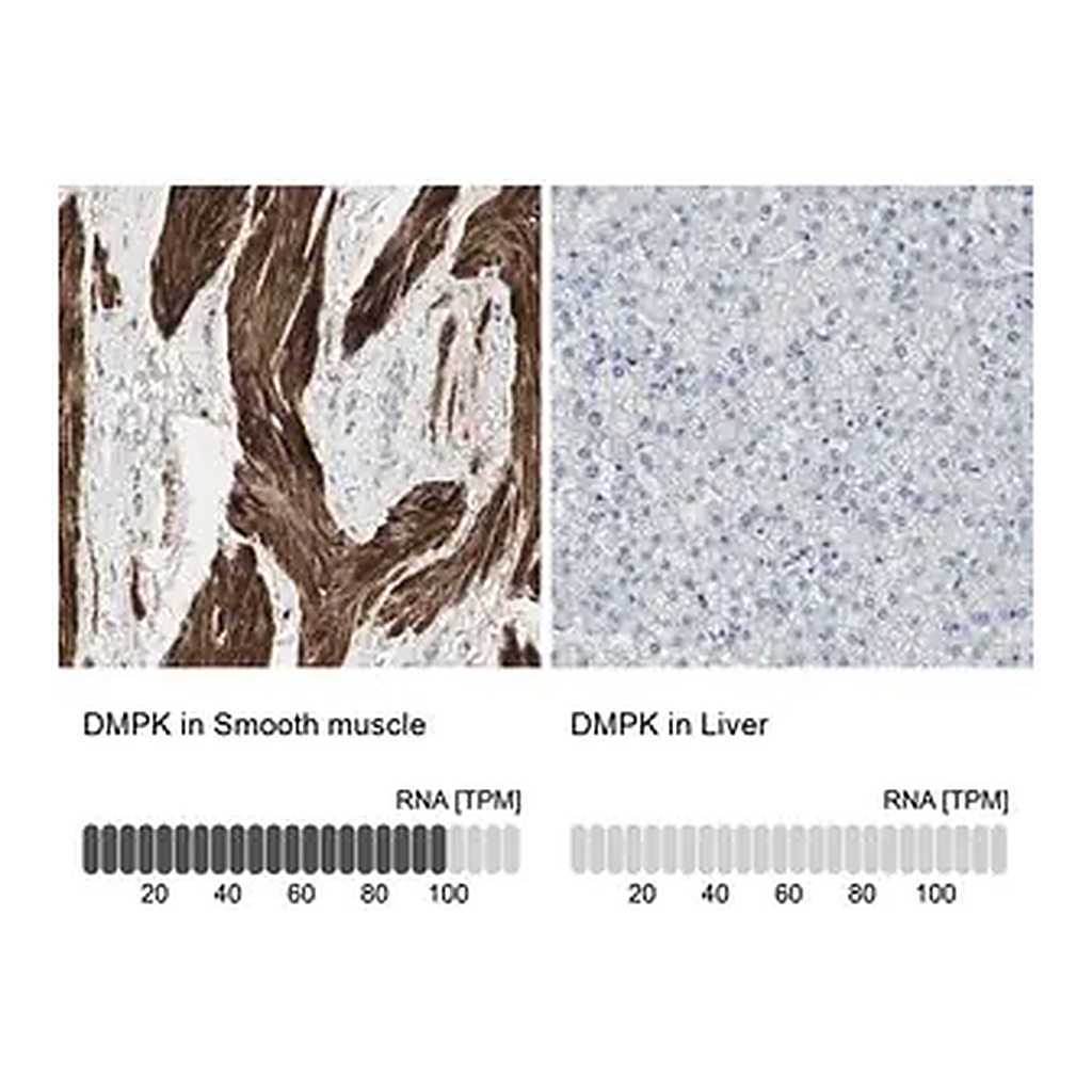 Merck Anti-DMPK antibody produced in rabbit