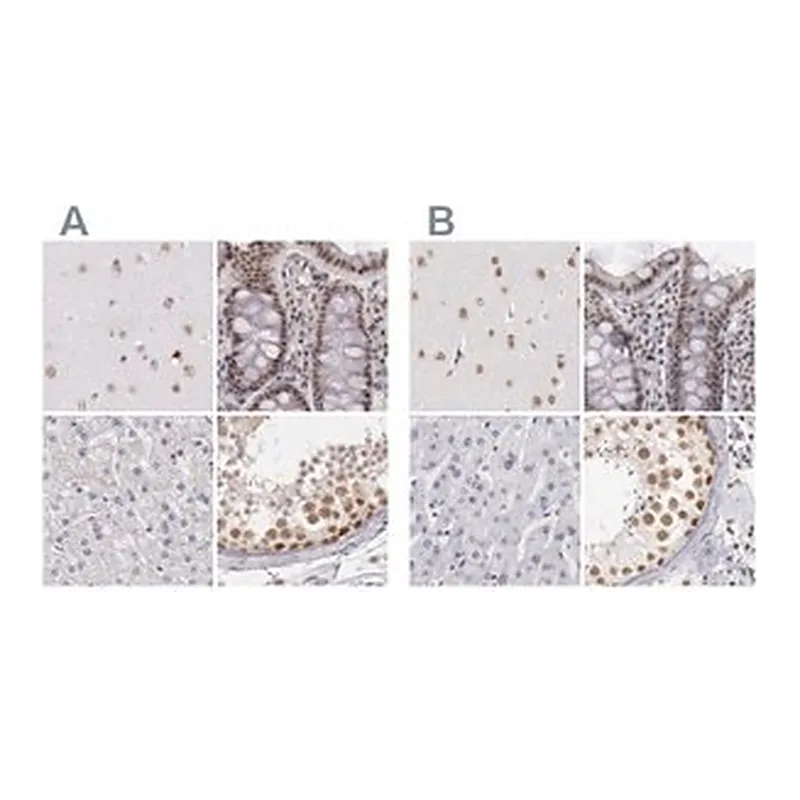 Merck Anti-DGCR14 antibody produced in rabbit