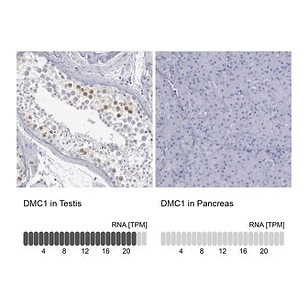 Merck Anti-DMC1 antibody produced in rabbit