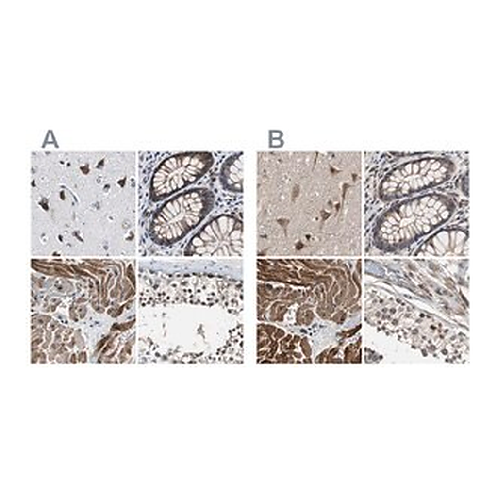 Merck Anti-PITRM1 antibody produced in rabbit