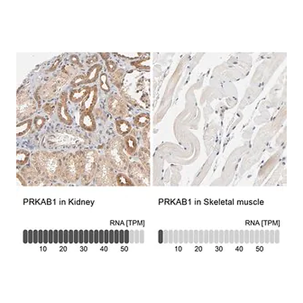 Merck Anti-PRKAB1 antibody produced in rabbit