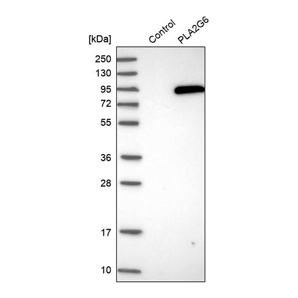 Merck Anti-PLA2G6 antibody produced in rabbit