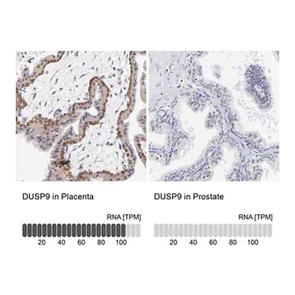 Merck Anti-DUSP9 antibody produced in rabbit