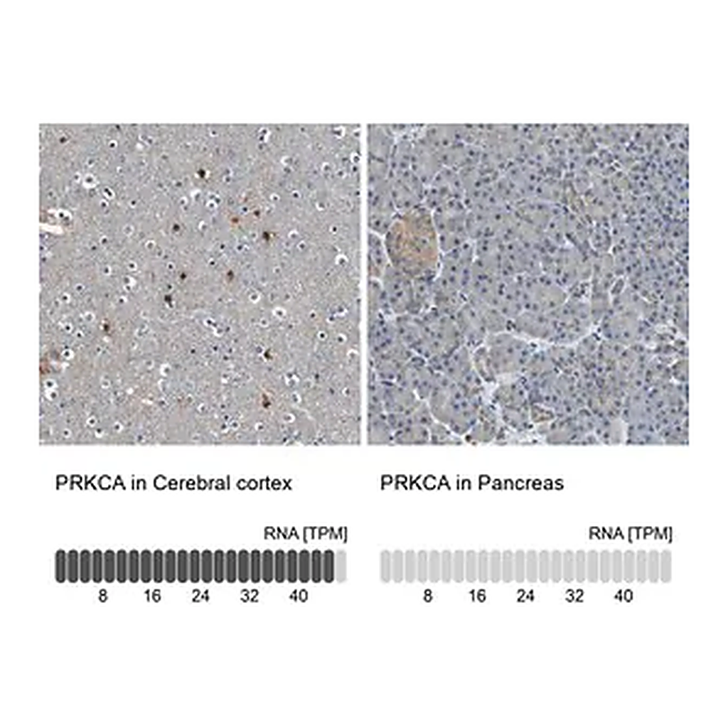 Merck Anti-PRKCA antibody produced in rabbit
