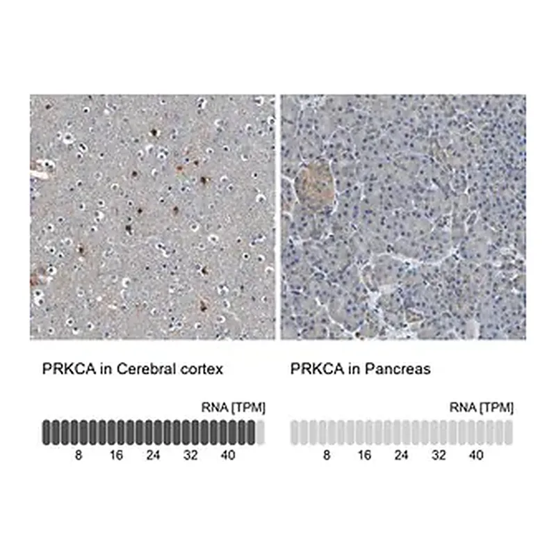 Merck Anti-PRKCA antibody produced in rabbit