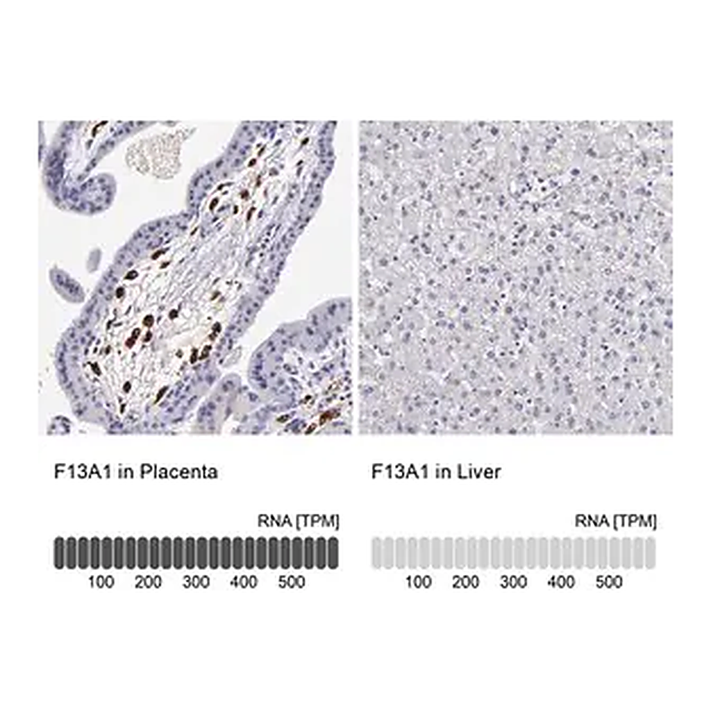 Merck Anti-F13A1 antibody produced in rabbit