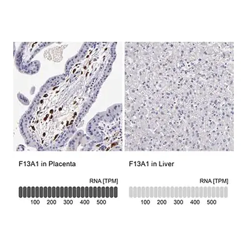 Merck Anti-F13A1 antibody produced in rabbit