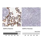 Merck Anti-EGFR antibody produced in rabbit