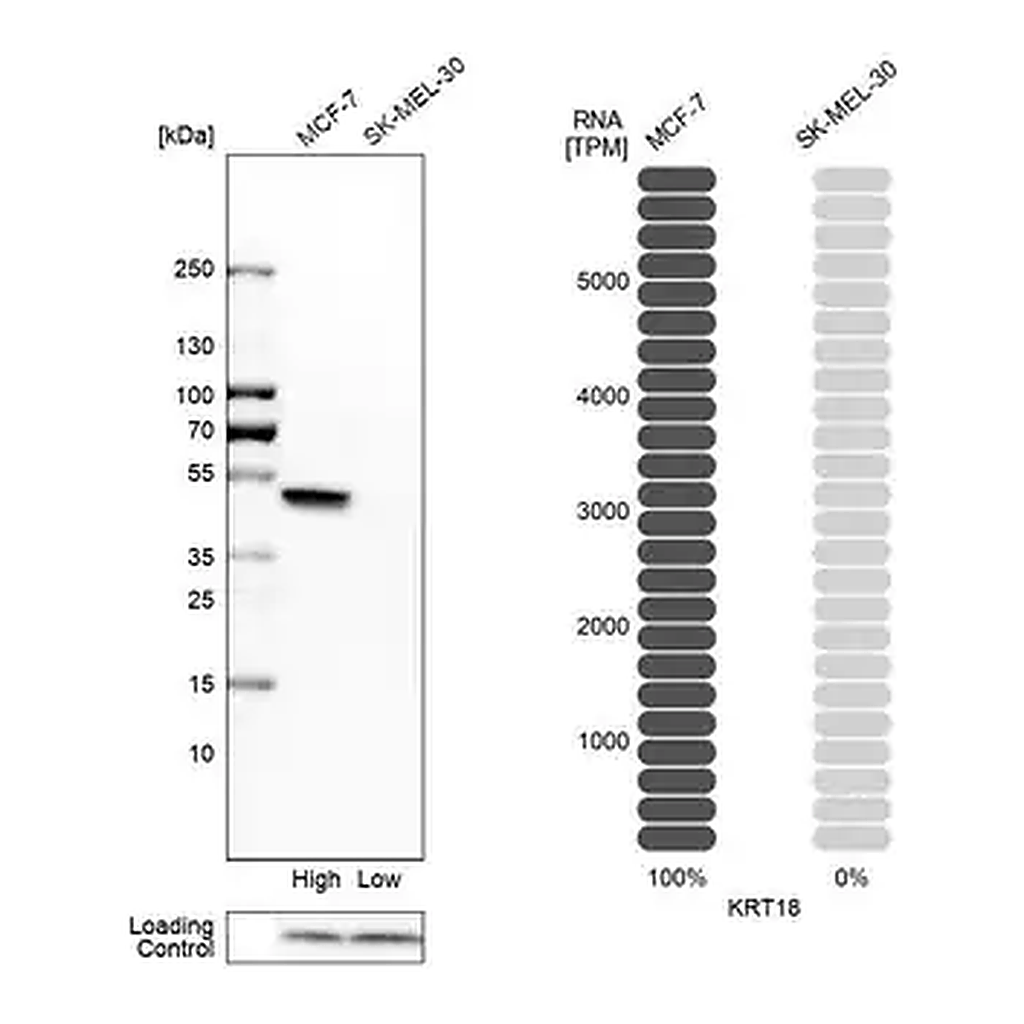 Merck Anti-KRT18 antibody produced in rabbit