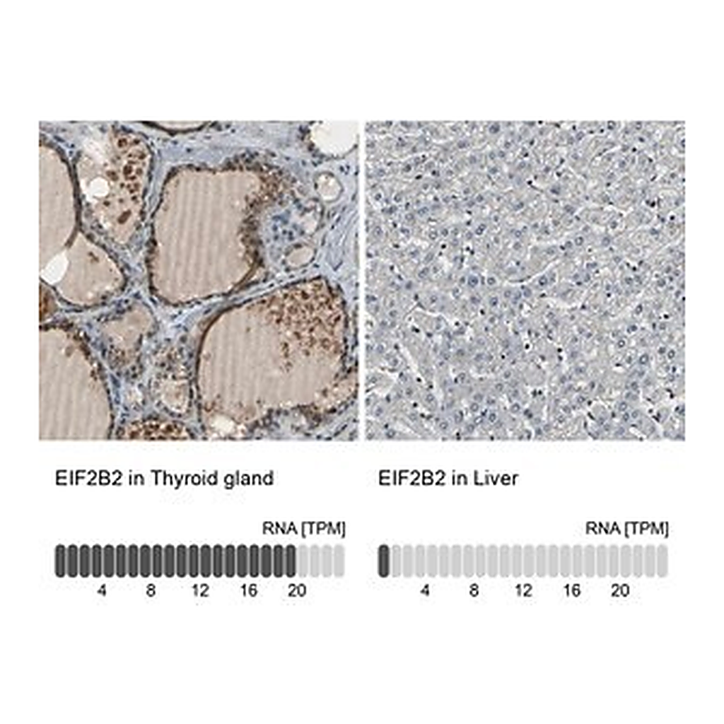 Merck Anti-EIF2B2 antibody produced in rabbit