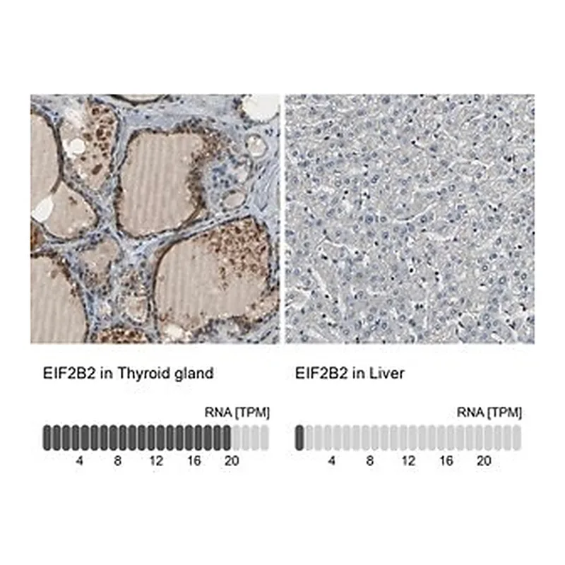 Merck Anti-EIF2B2 antibody produced in rabbit
