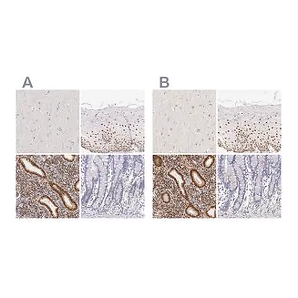 Merck Anti-ESR1 antibody produced in rabbit