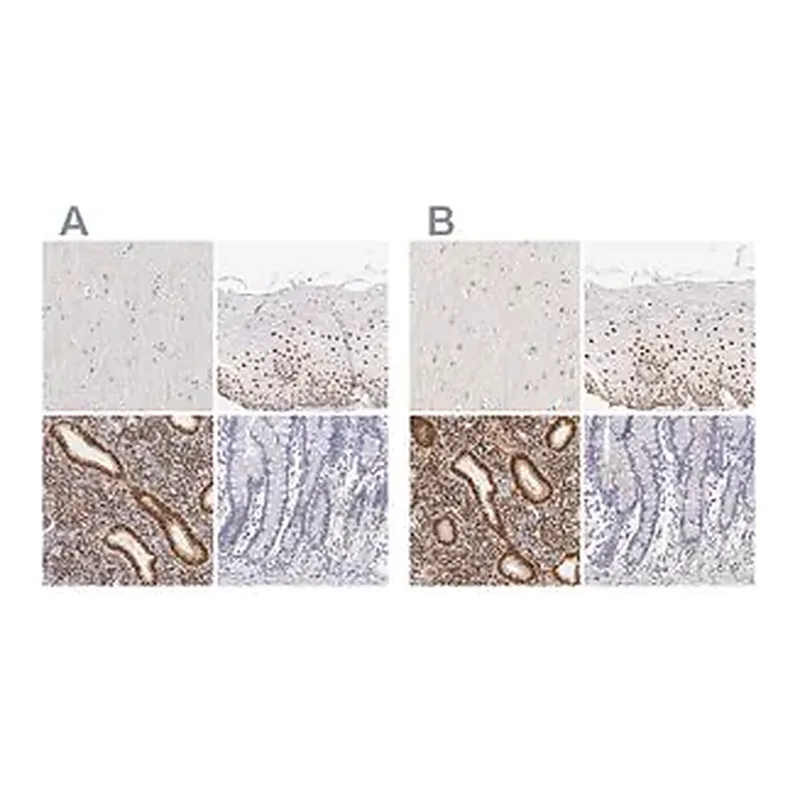 Merck Anti-ESR1 antibody produced in rabbit