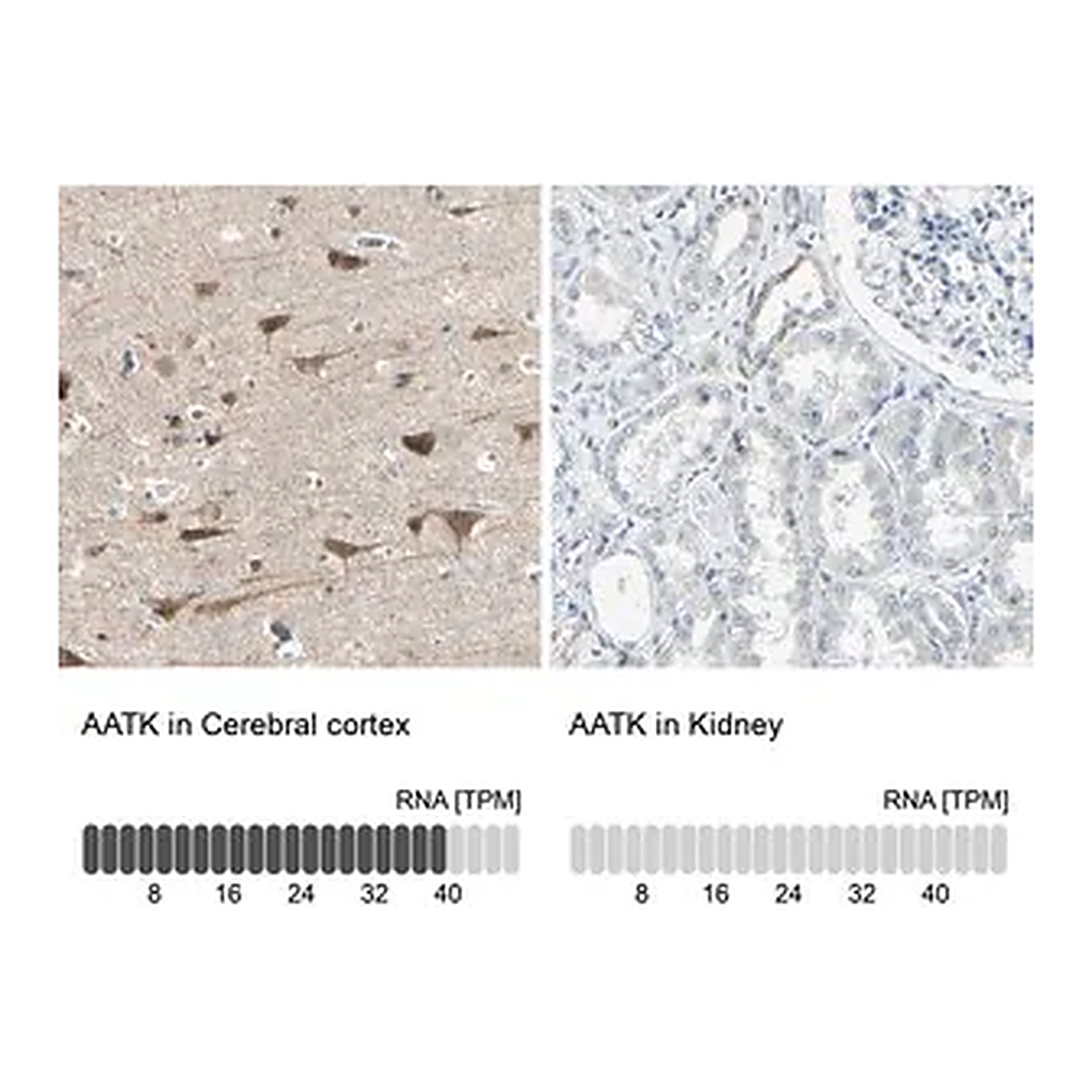 Merck Anti-AATK antibody produced in rabbit
