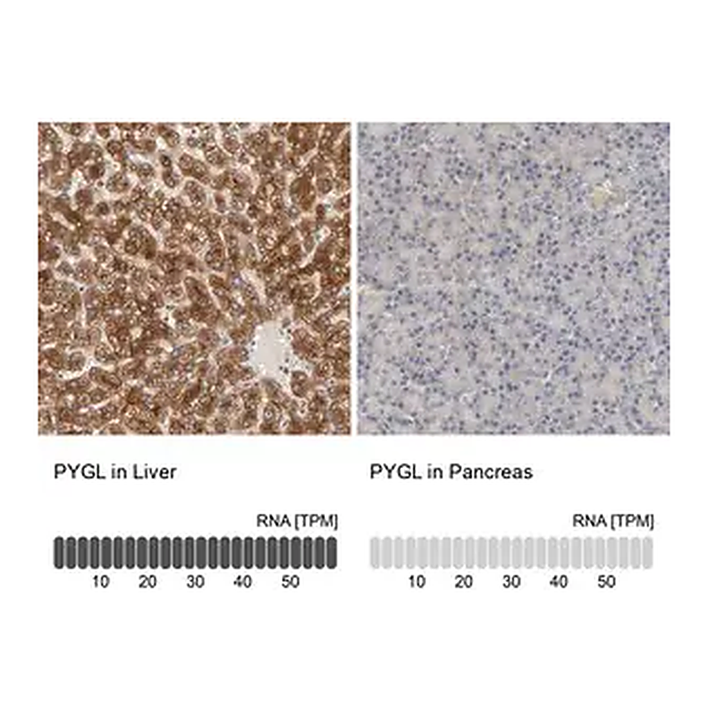 Merck Anti-PYGL antibody produced in rabbit