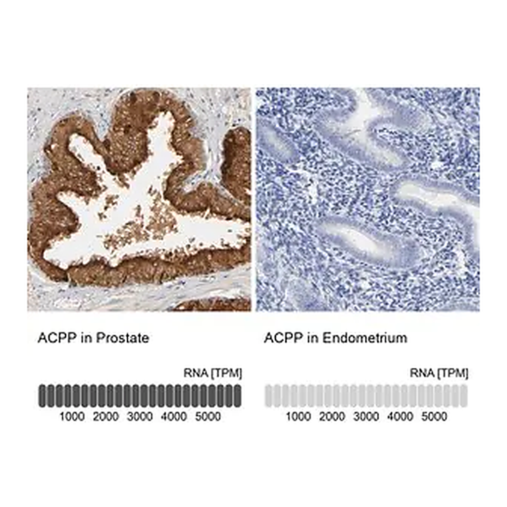 Merck Anti-ACPP antibody produced in rabbit