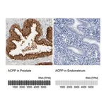 Merck Anti-ACPP antibody produced in rabbit