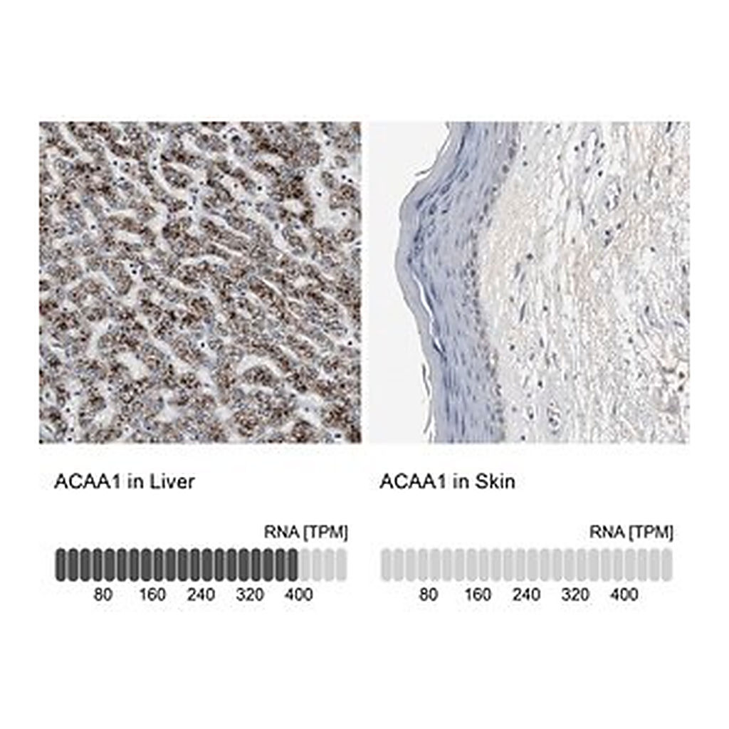 Merck Anti-ACAA1 antibody produced in rabbit