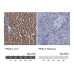 Merck Anti-PYGL antibody produced in rabbit
