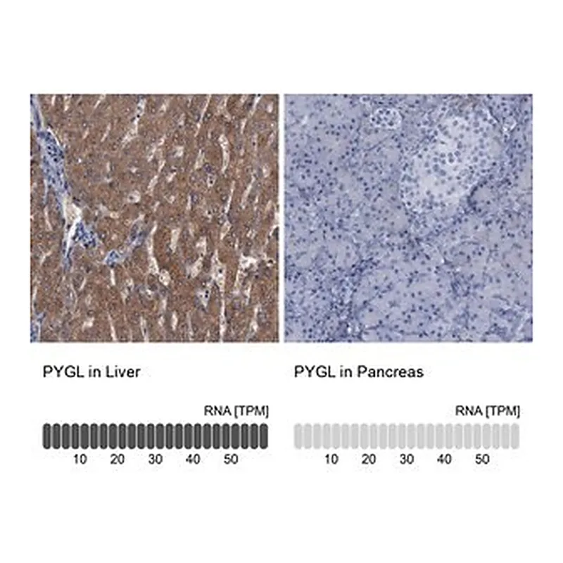 Merck Anti-PYGL antibody produced in rabbit