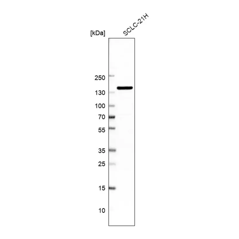 Merck Anti-AKAP1 antibody produced in rabbit