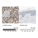 Merck Anti-ACADM antibody produced in rabbit