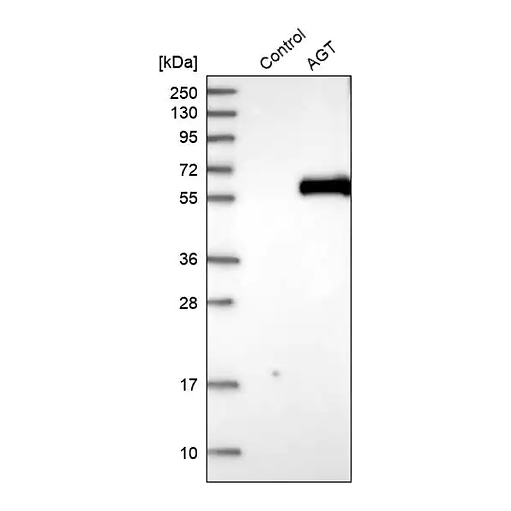 Merck Anti-AGT antibody produced in rabbit