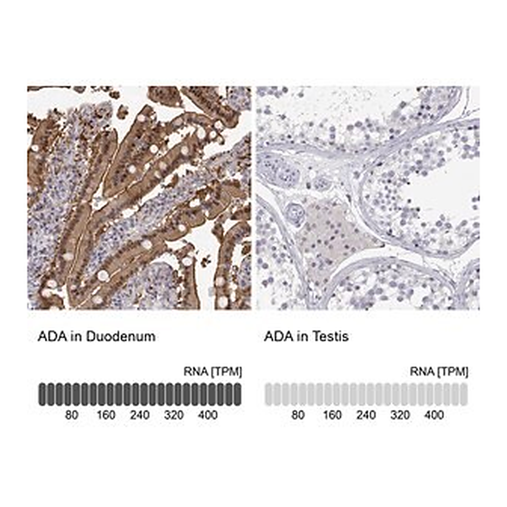 Merck Anti-ADA antibody produced in rabbit