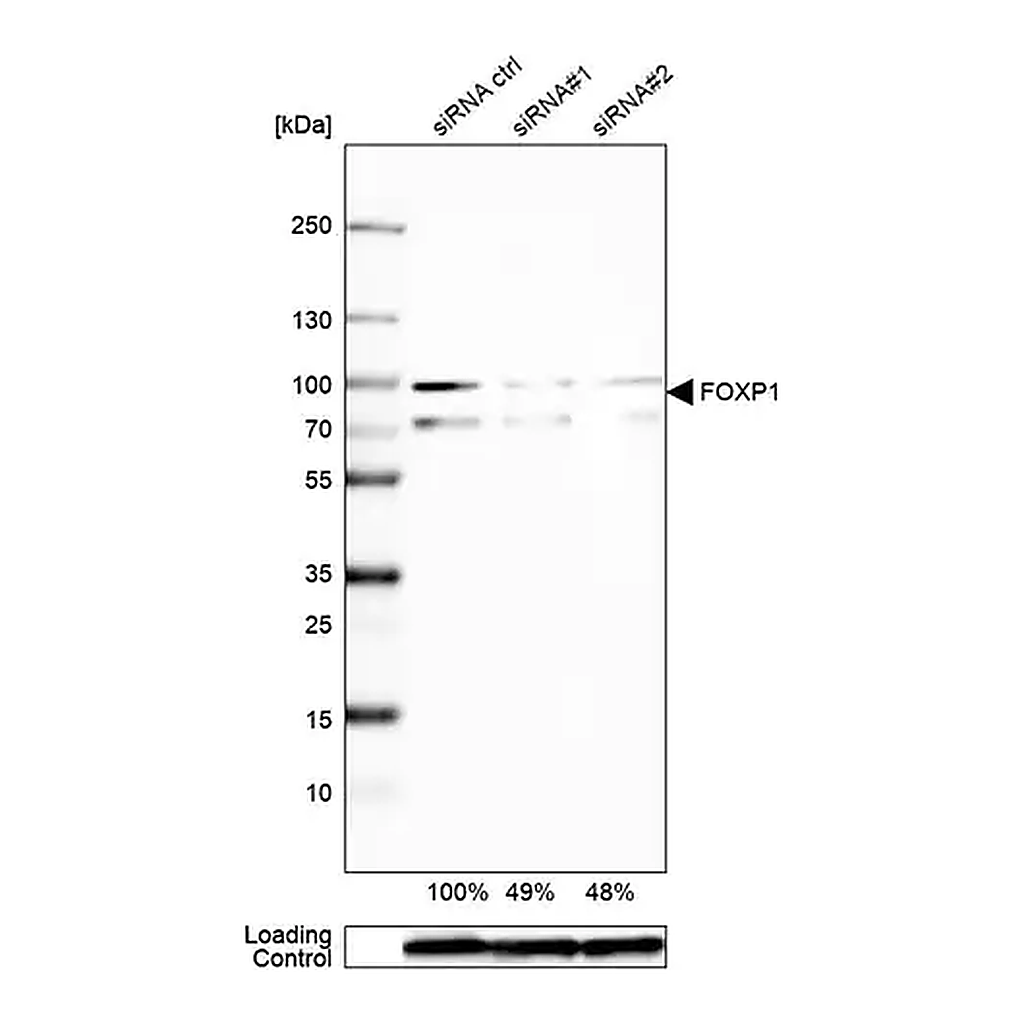 Merck Anti-FOXP1 antibody produced in rabbit