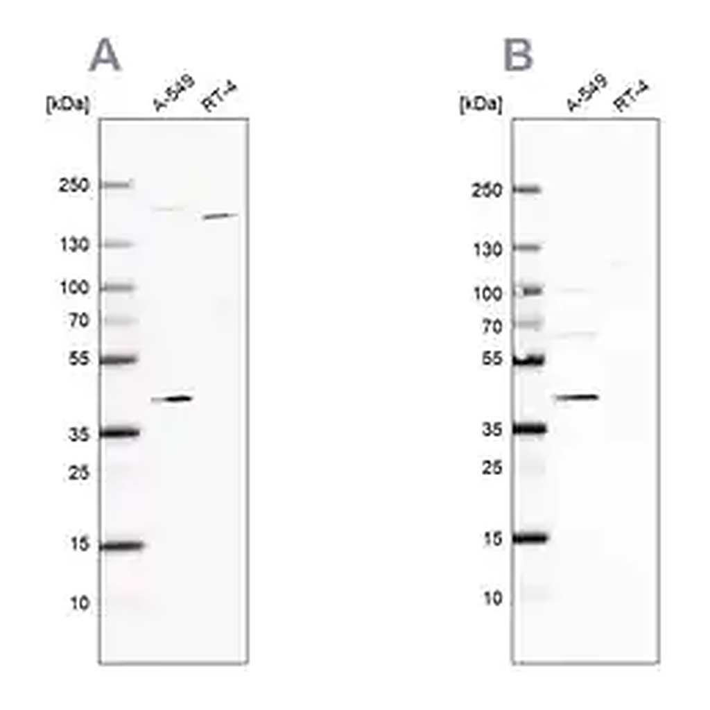 Merck Anti-GALK1 antibody produced in rabbit