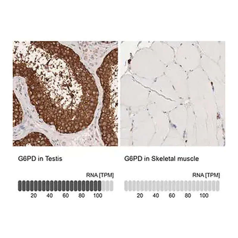 Merck Anti-G6PD antibody produced in rabbit