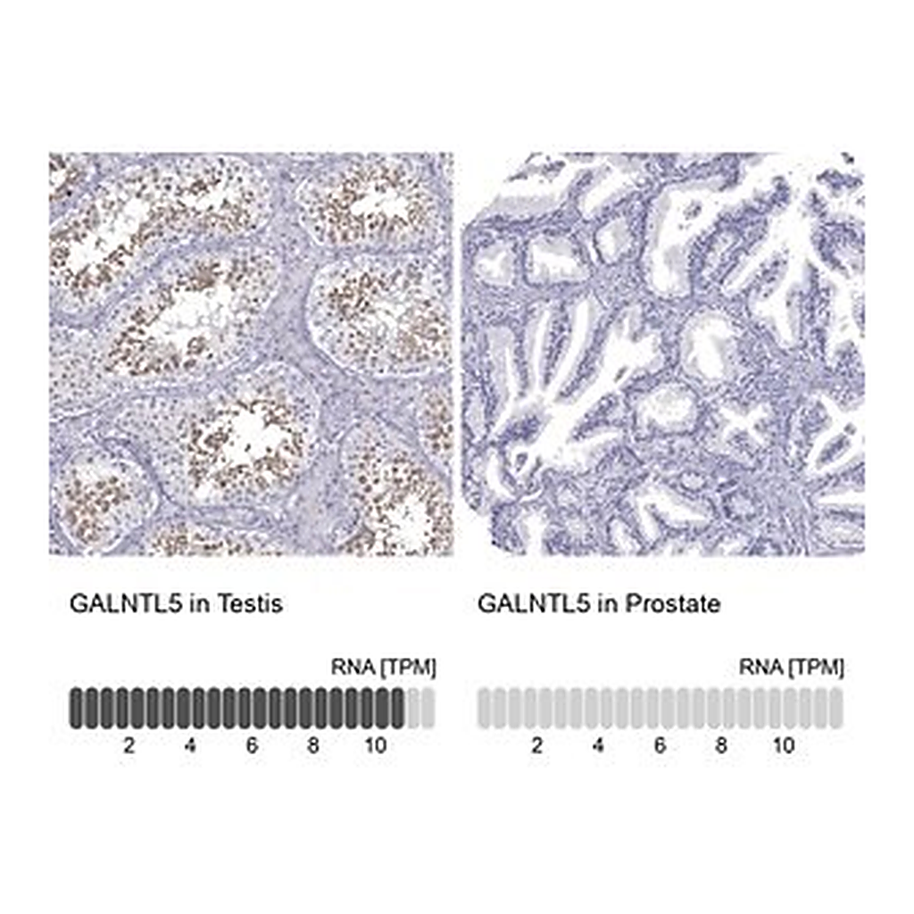 Merck Anti-GALNTL5 antibody produced in rabbit