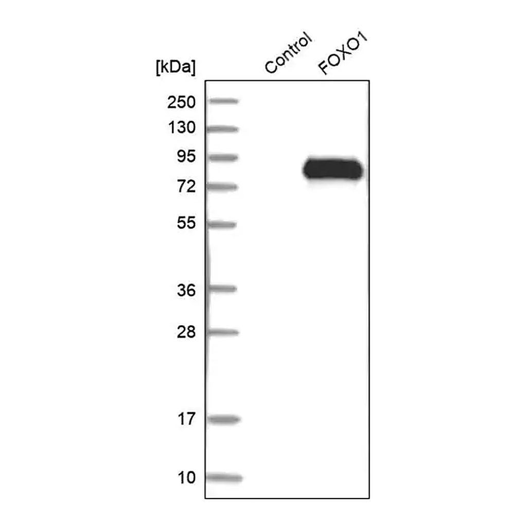 Merck Anti-FOXO1 antibody produced in rabbit