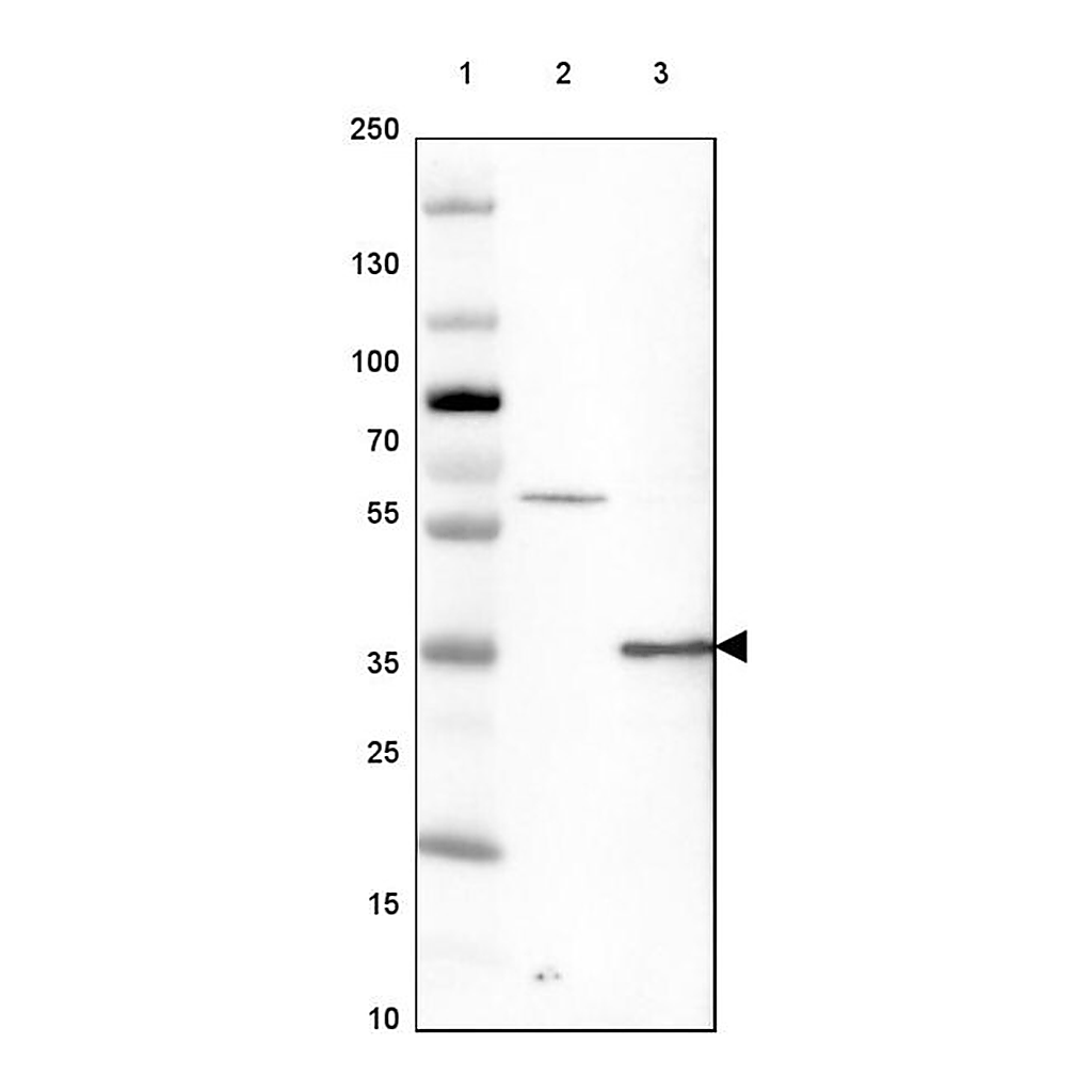 Merck Anti-GATAD1 antibody produced in rabbit