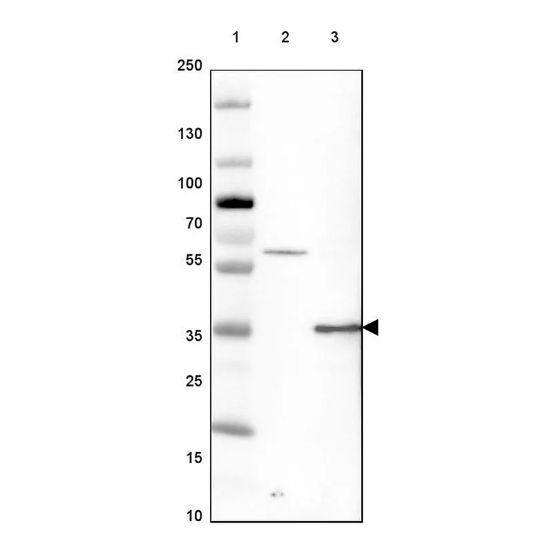 Merck Anti-GATAD1 antibody produced in rabbit