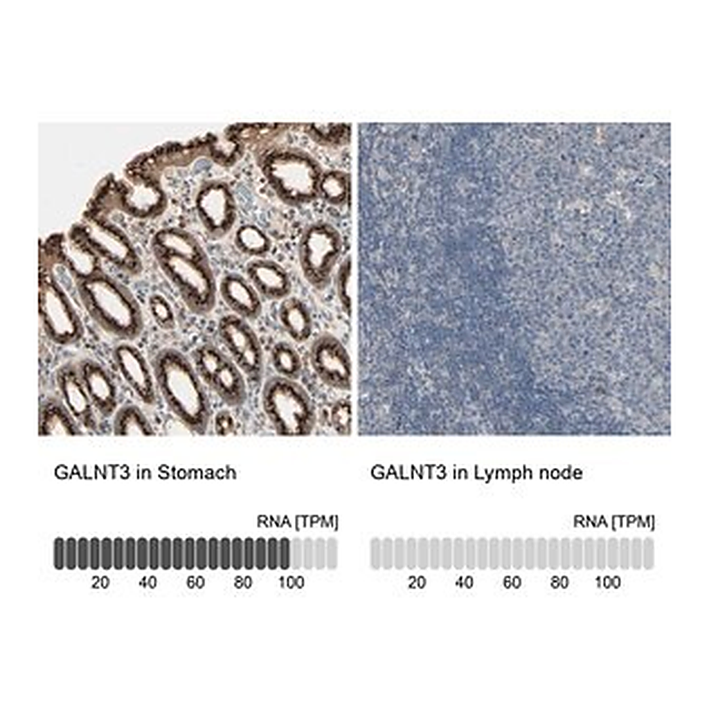 Merck Anti-GALNT3 antibody produced in rabbit