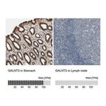 Merck Anti-GALNT3 antibody produced in rabbit