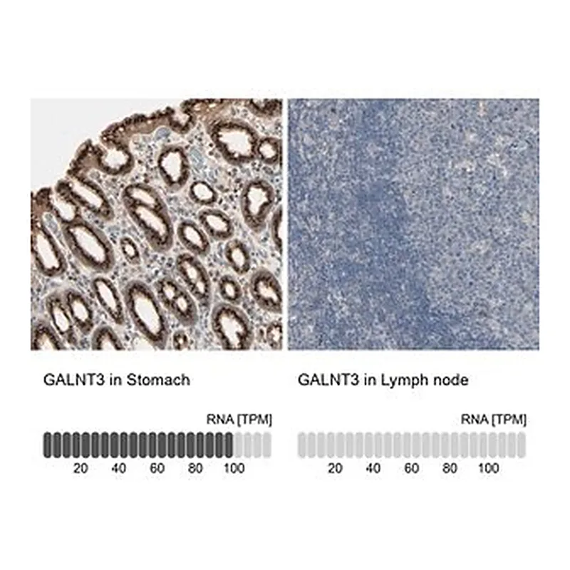 Merck Anti-GALNT3 antibody produced in rabbit