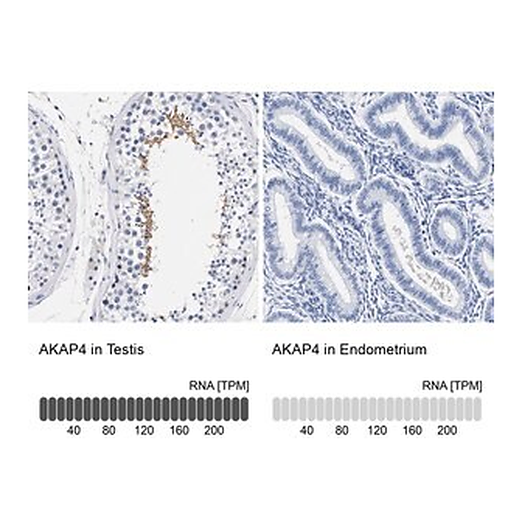 Merck Anti-AKAP4 antibody produced in rabbit
