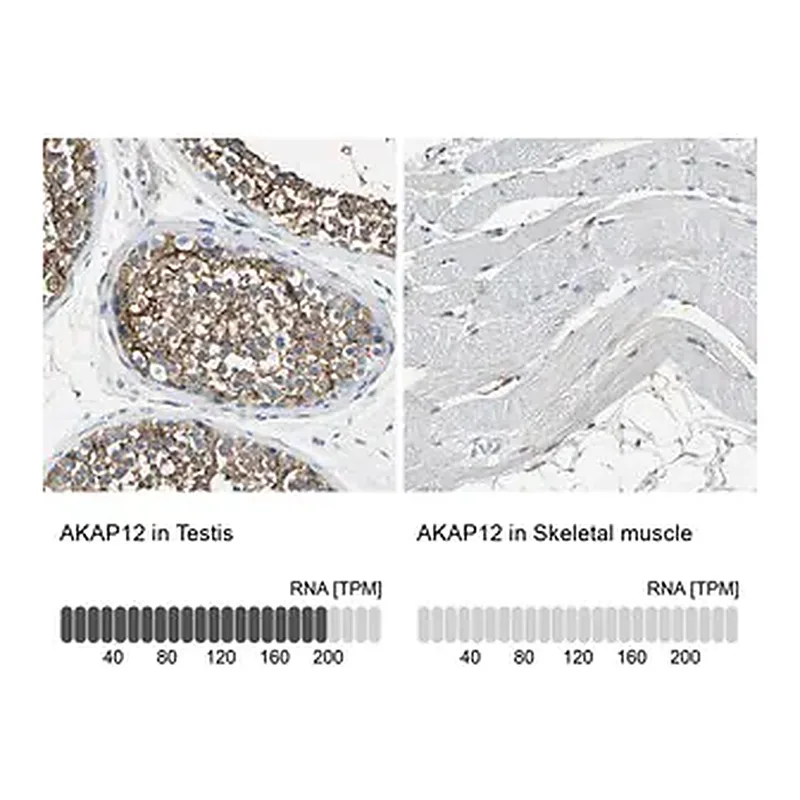 Merck Anti-AKAP12 antibody produced in rabbit