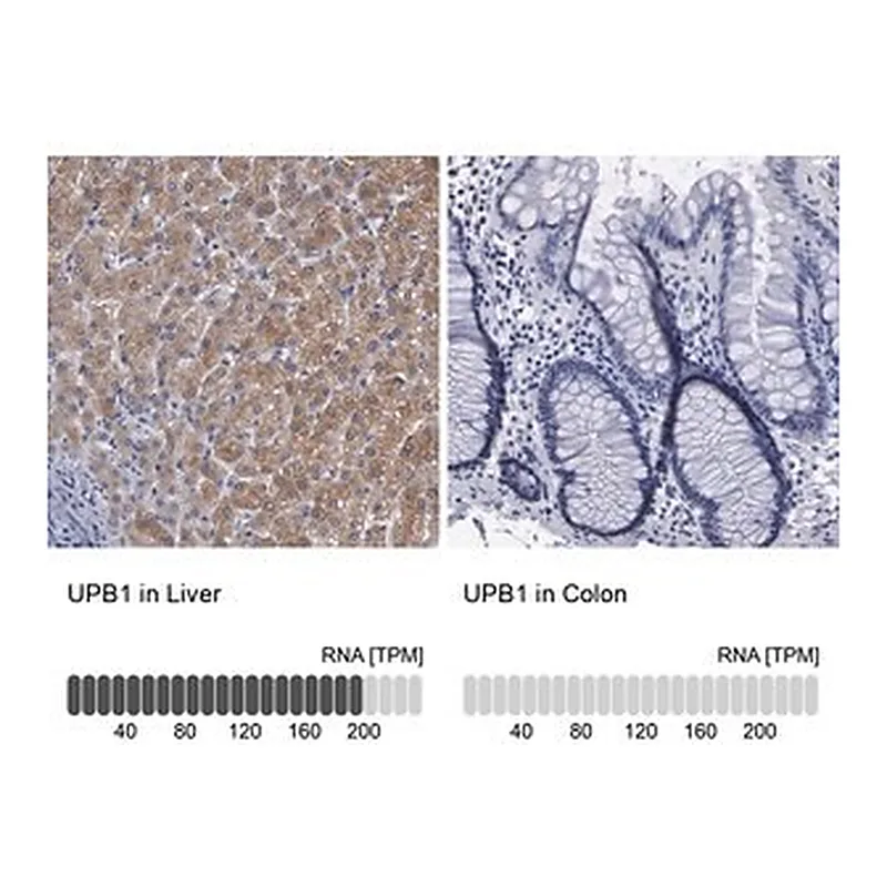 Merck Anti-UPB1 antibody produced in rabbit