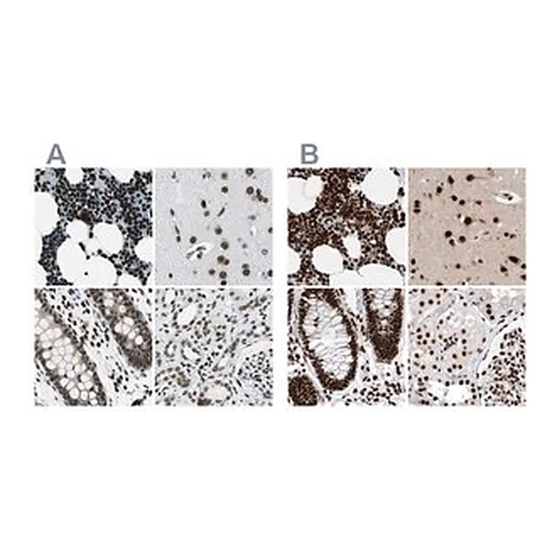 Merck Anti-BCLAF1 antibody produced in rabbit