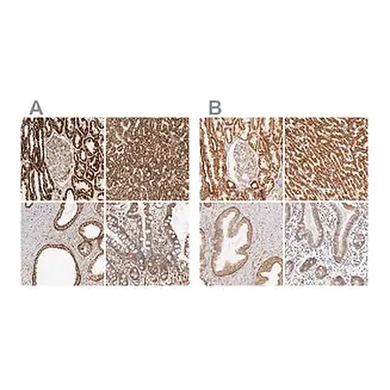 Merck Anti-ATP5B antibody produced in rabbit