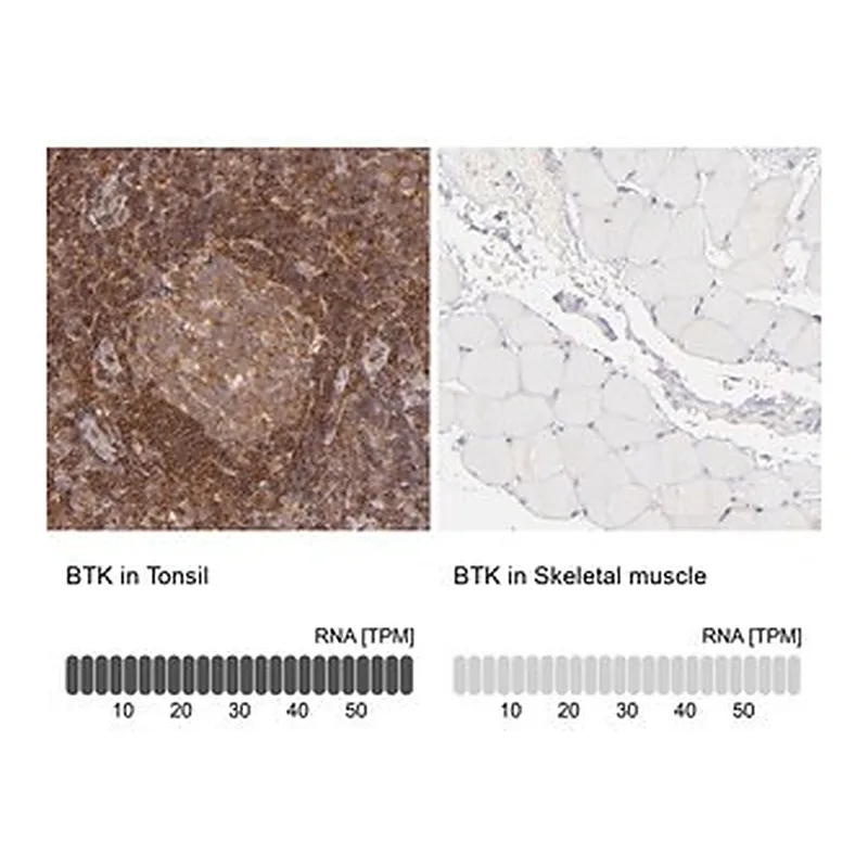 Merck Anti-BTK antibody produced in rabbit