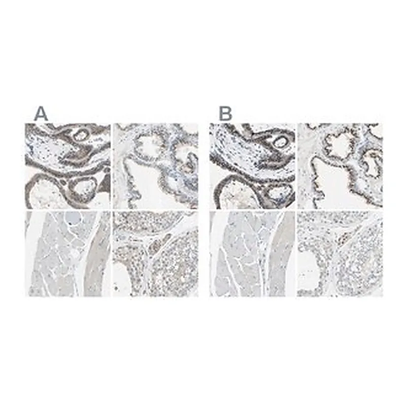 Merck Anti-B4GALT1 antibody produced in rabbit