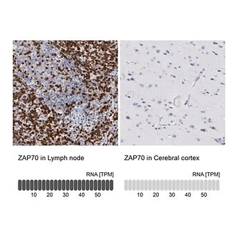 Merck Anti-ZAP70 antibody produced in rabbit