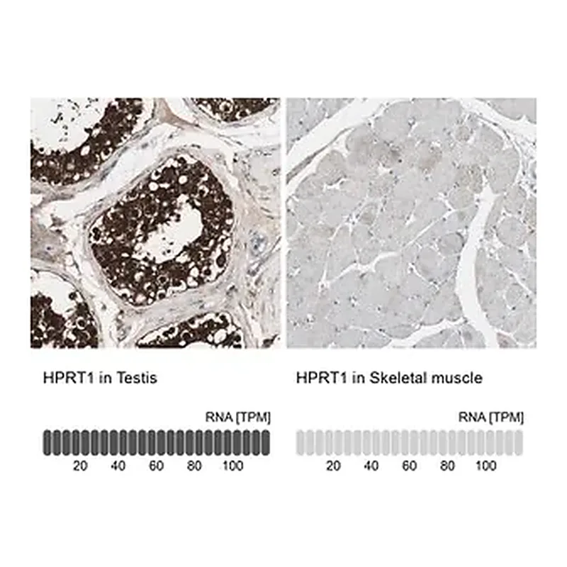 Merck Anti-HPRT1 antibody produced in rabbit